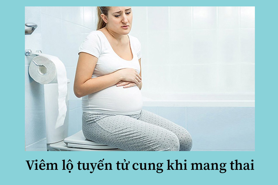 Viêm lộ tuyến tử cung khi mang thai