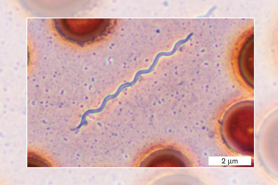 Xoắn khuẩn Borrelia